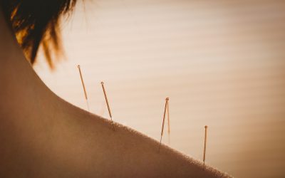 Comment être pris en charge pour ses séances d&rsquo;acupuncture ?